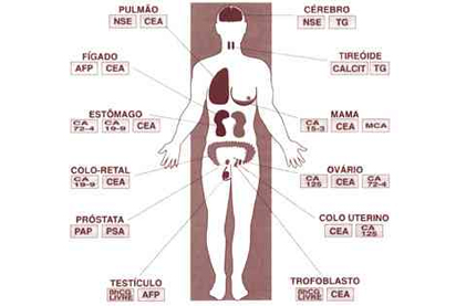 Exame de Sangue - CA 125 20/09/2011